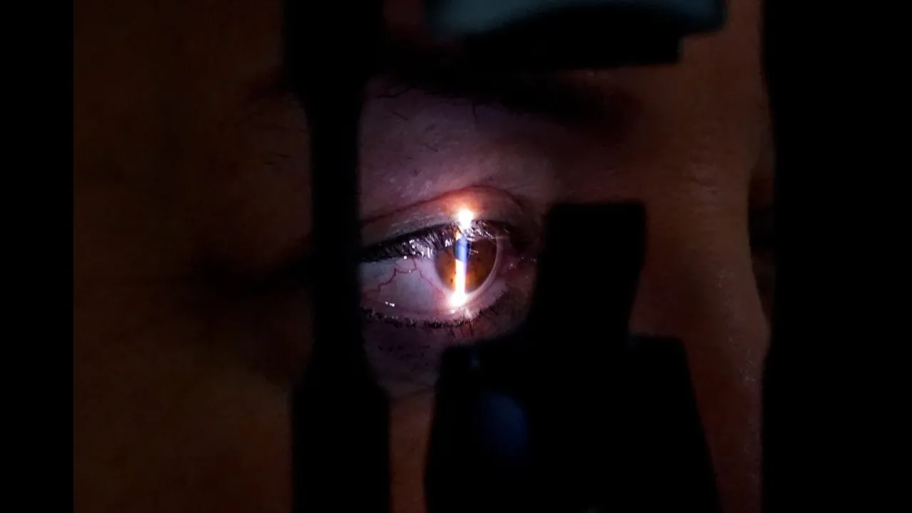 Lensle denize girmek görme kaybı riski taşıyor